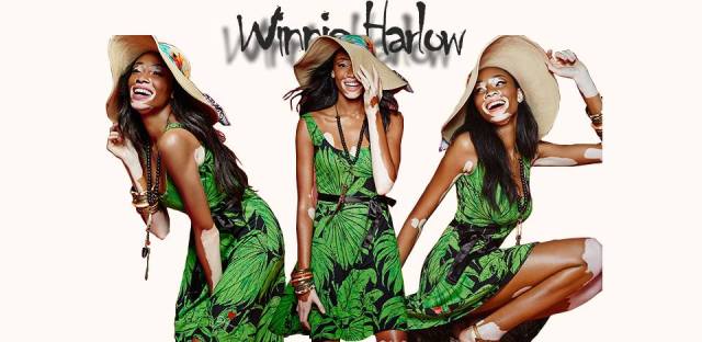 Winnie.Harlow.Desigual.brand.ambassador.2015